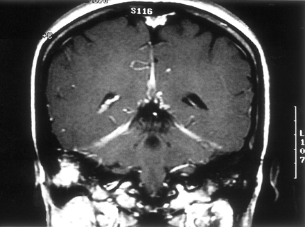Fig 5.