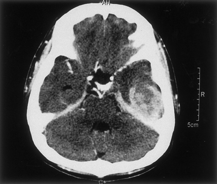 Fig 6.