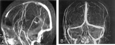 Fig 9.