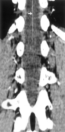 Fig 4.