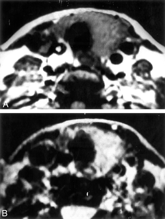 Fig 4.