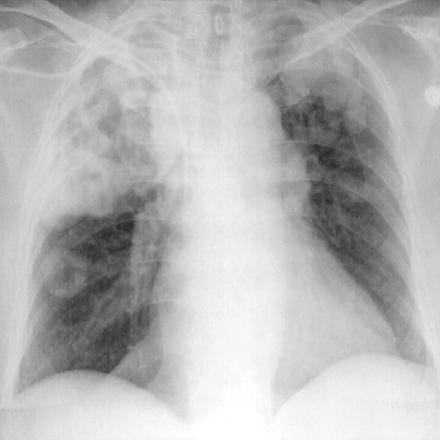 Fig 1.
