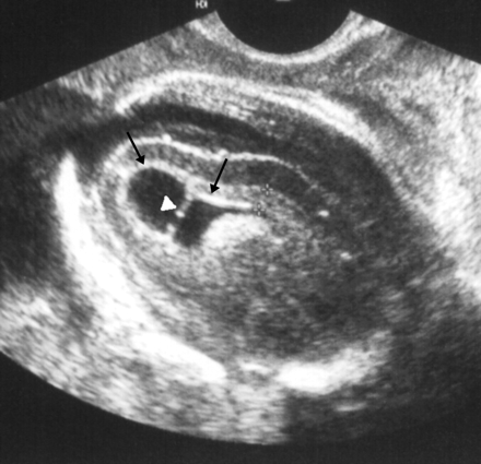 Fig 1.