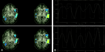 Fig 3.