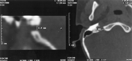 Fig 2.