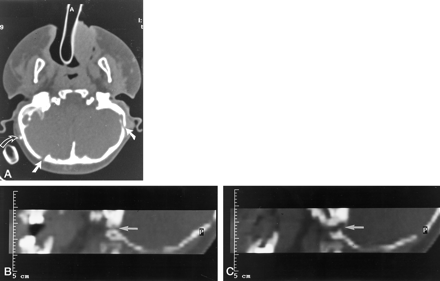 Fig 3.