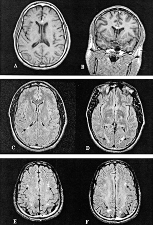 Fig 3.