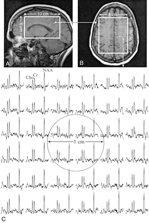 Fig 2.