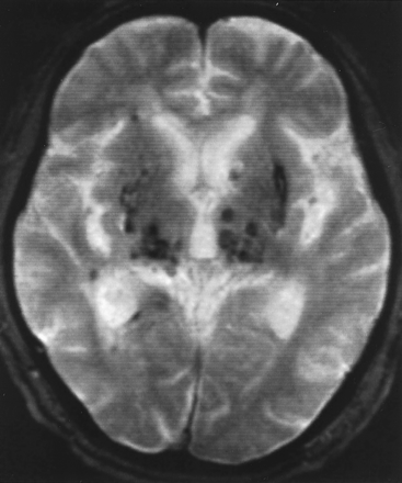 Fig 4.