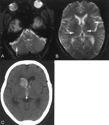 Fig 7.