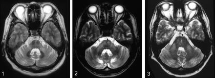 Fig 2.