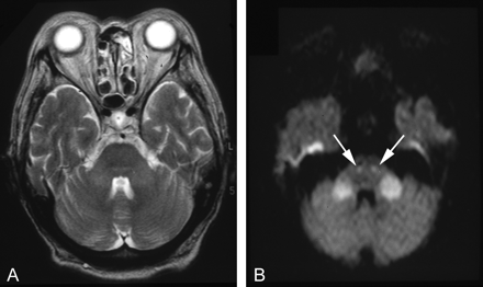 Fig 4.