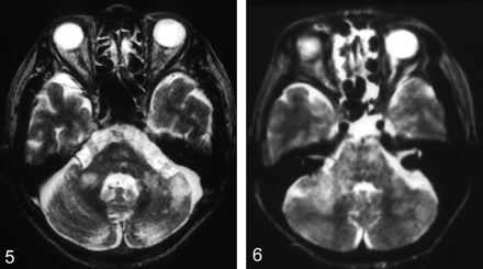 Fig 5.