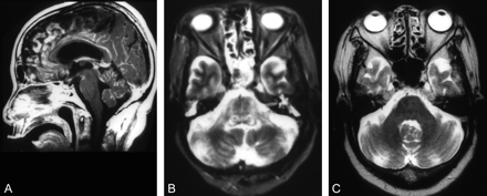 Fig 7.