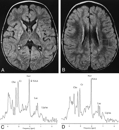Fig 1.