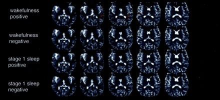Fig 5.