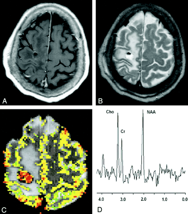 Fig 2.