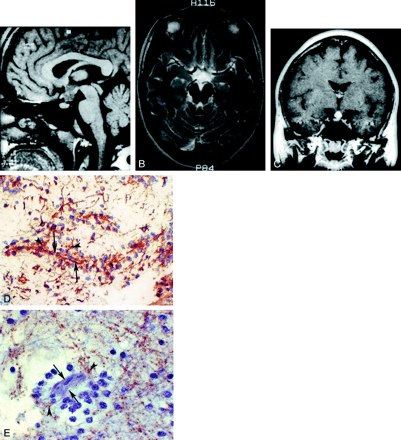 Fig 3.