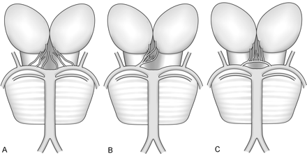 Fig 4.