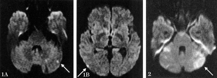 Fig 2.