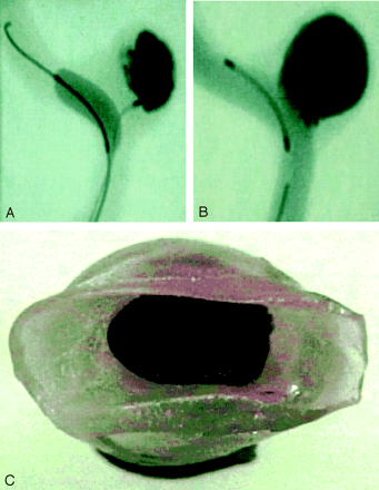 Fig 2.
