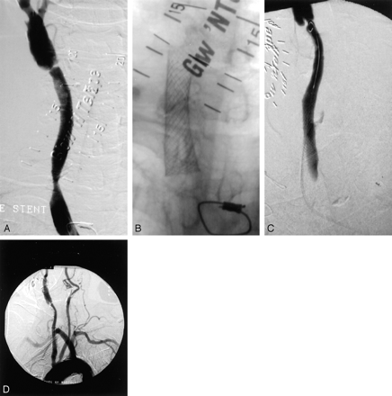 Fig 1.