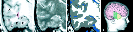 Fig 1.