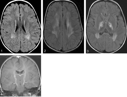 Fig 4.