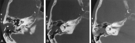 Fig 1.