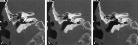 Fig 2.