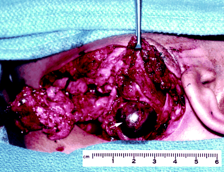 Fig 2.