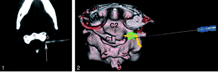 Fig 2.