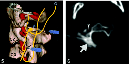 Fig 6.