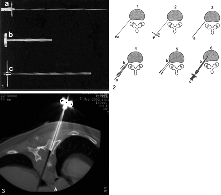 Fig 2.