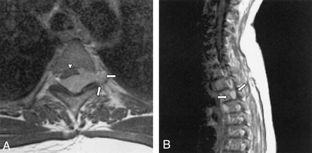 Fig 3.