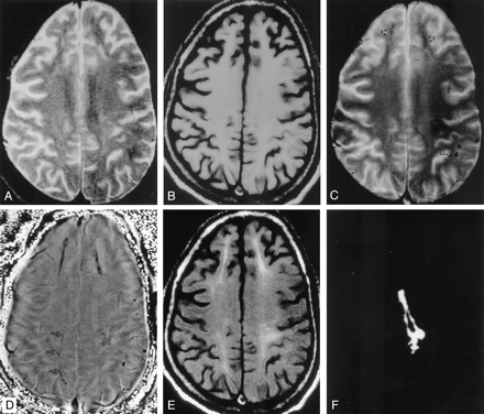 Fig 3.