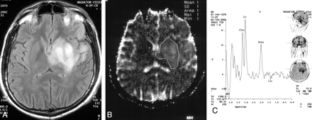 Fig 4.