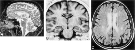 Fig 1.