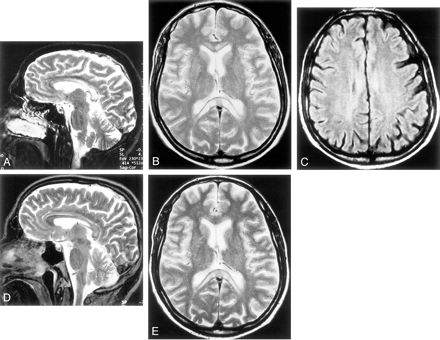 Fig 2.