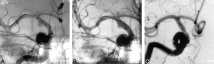 Fig 2.