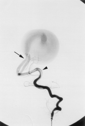 Fig 1.