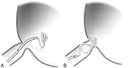 Fig 5.