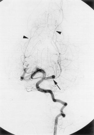 Fig 6.