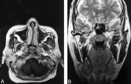 Fig 1.