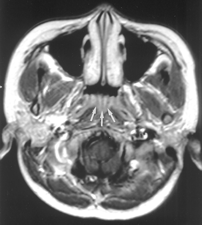 Fig 4.