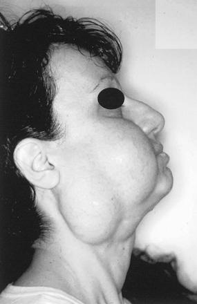 Fig 1.