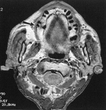 Fig 2.
