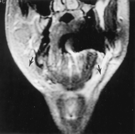 Fig 5.