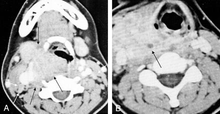 Fig 3.