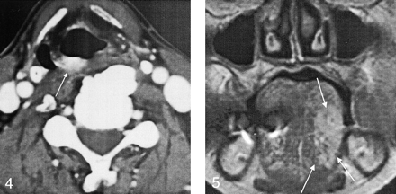 Fig 4.